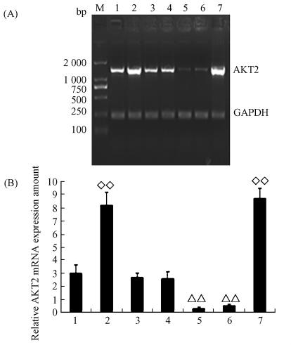 11 AKT2 1049 Fig 4 Detection of AKT2 mrna expression by RT- PCR The expression of AKT2 mrna in AKT2 / MCF- 7 DN-AKT2 / MCF-7 and empty vector / MCF-7 stable transfectants and untransfected MCF-7