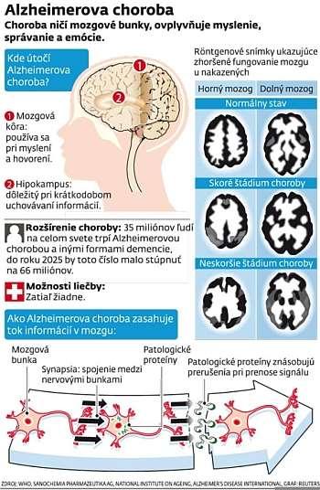 Alois Alzheirmer r. 1905 výskyt Europa 7 milionov 100 000 opatrovateľov V r. 2005 náklady 149 miliard E v roku 2040 dvojnásobný vzostup?