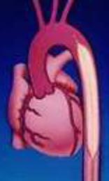 distal (1-2 cm) to the