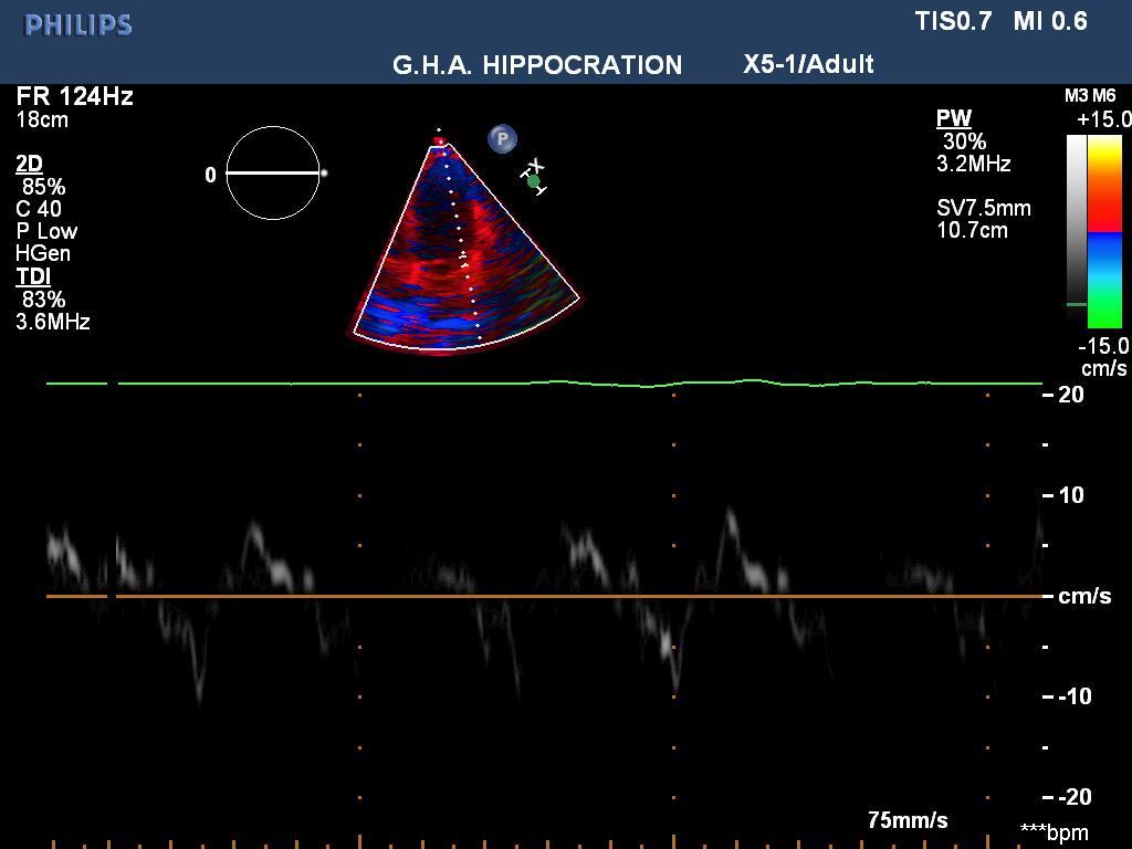 E=111 cm/s