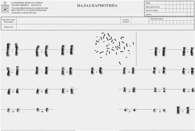 Hromozom χρώμα (hroma) - boja i σώμα (soma) telo Sposobnost bojenja hromozoma je bila osnov na kojoj su se bazirale pionirske metode za analizu hromozoma Skup svih hromozoma u jednoj ćeliji, sa