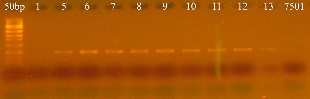 Prednosti PCR metode Visoka senzitivnost koja se pre svega odnosi na minimalnu količinu matrice DNK neophodne za amplifikaciju određenog fragmenta; Visoka specifičnost PCR reakcije