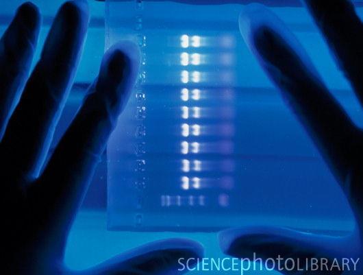 Molekularno-biološke metode za analizu molekula RNK Northern blot