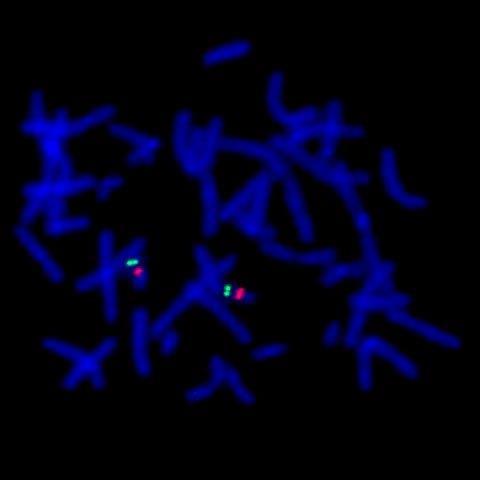 Fluorescentna in situ hibridizacija - FISH Prednost u odnosu na