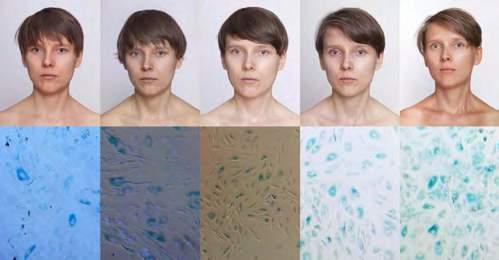 In the second stage of the project I explored the process of my cellular aging (in the meaning of passing by), comparing the resulting biological material with observations of visual changes of my