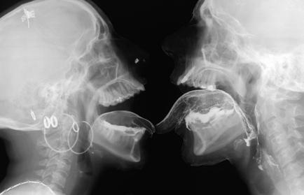 These images possess a similar, ghostly, inner view of the human body and delve below the skin to illuminate who and what we are, both physically and also in a spiritual sense.