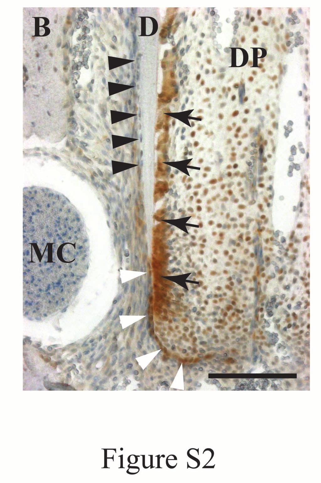 Figure S2: Dlx3 expression in the developing root Dlx3 expression during radiculogenesis of the first molar at P15. Immunohistochemical analysis using anti- Dlx3 antibody on molar section.