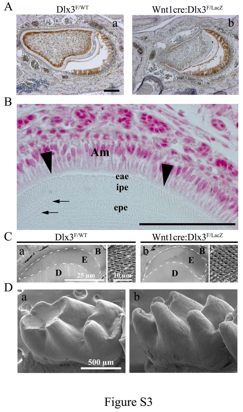 Figure S3: Ameloblast differentiation and enamel formation in Wnt1- cre:dlx3 F/LacZ mice A) Immunohistochemical analysis of Dlx3 expression in mandibular incisors (cross sections) from WT and cko