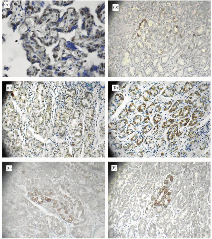 11 DNMT 1035 Fig 1 Expressions of DNMT in placenta tissues and gastric mucosa tissues DNMT proteins were detected by Immunohistochemistry using anti-dnmt antibodies 1 50 Santa Cruz A Expression of