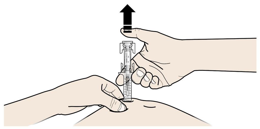 kad sušvirkštumėte visą dozę. C ATITRAUKITE nykštį. Tuomet PATRAUKITE švirkštą nuo odos.