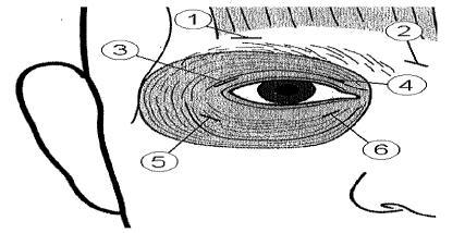 Για τις ενέσεις στο άνω βλέφαρο, η βελόνη πρέπει να κατευθυνθεί μακριά από το κέντρο προς αποφυγή τρώσης του ανελκτήρος μυός. Παρατίθεται ένα διάγραμμα για τις θέσεις των ενέσεων.