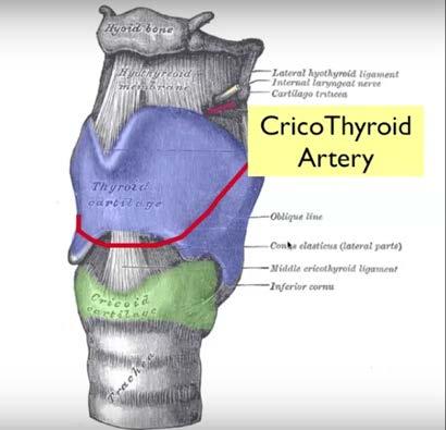 Μπορεί κανείς να παρακολουθήσει μια απλή ανατομική προσέγγιση της κρικοθυρεοειδικής μεμβράνης στην ακόλουθη ηλεκτρονική διεύθυνση (https://www.youtube.com/watch?v=ziquutickvg ).