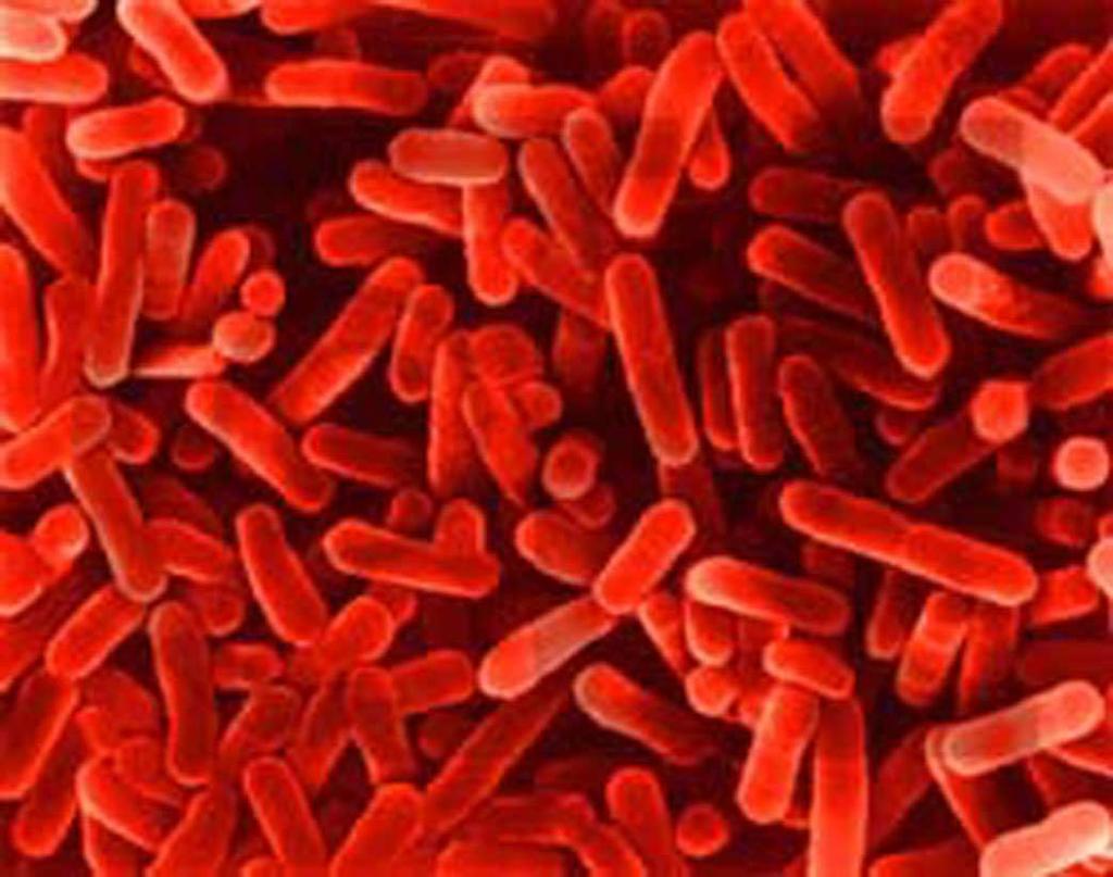 Legionella pneumophila Ubikvitárna baktéria