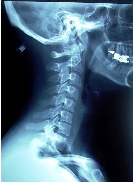 Case 22 Απεικόνιση όλων των ανατομικών δομών (Α1-Θ1). Ανάδειξη της αεροφόρου κοιλότητας (φάρυγγα και τραχεία).