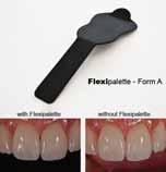 ΕΞΥΠΝΑ ΕΡΓΑΛΕΙΑ ΚΑΙ ΣΥΣΚΕΥΕΣ Flexipalette Η Smile Line σε συνεργασία με την Styleitaliano, μια ομάδα κλινικών και ερευνητών με πάθος για την Αισθητική Οδοντοπροσθετική, σας