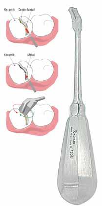 PLIER Αμαλγαματοφόροι 8226 7,44 ΣΥΡΙΓΓΑ CARPULE