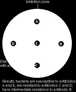 METODE ZA DOLOČANJE OBČUTLJIVOSTI BAKTERIJ ZA ANTIBIOTIKE-