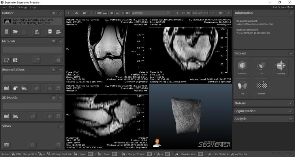 Εικόνα 6.1 Περιβάλλον Dornheim Segmenter με Δεδομένα Ιατρικής Απεικόνισης 6.