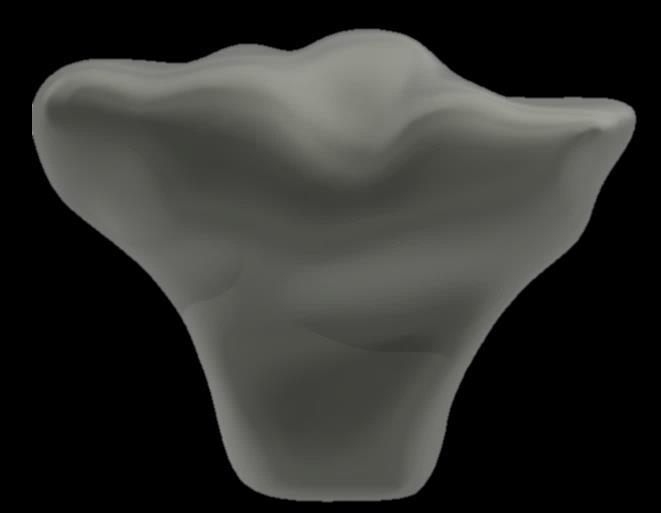 άρθρωση του γονάτου, τα οποία αξιοποιήθηκαν για τη γεωμετρική μοντελοποίηση τους στο λογισμικό CAD. 6.