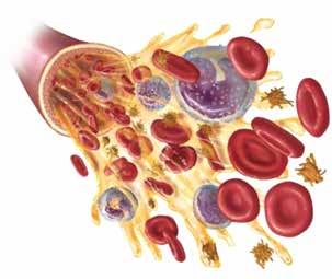 Ένα ερυθρό αιμοσφαίριο μόλις έχει απελευθερώσει το οξυγόνο του στα κύτταρα των κάτω άκρων του σώματος.