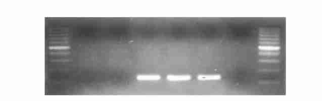 248 18 78 15 214 HLA2B2704 mrna Fig 3 Fig 2 Integration detection of HLA2B2704 gene by PCR in transgenic mice M:100 bp DNA ladder ; 1 2 :Negative control (genomic DNA of normal mice) ;3 4 : Genomic