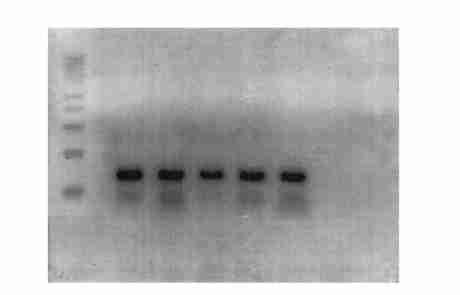 DNA ladder ; 1 2 3 4 : Total mrna extracted from co2 lon skin testicle and spleen of positive mice ;5 :Positive control (to2 tal mrna extracted from HLA2B27 positive human white blood cell) ; 6 :