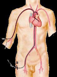 Καρδιακός καθετηριασμός Ο καρδιακός καθετηριασμός χωρίζεται σε δεξιό και αριστερό καρδιακό. Δεξιός καρδιακός καθετηριασμός.