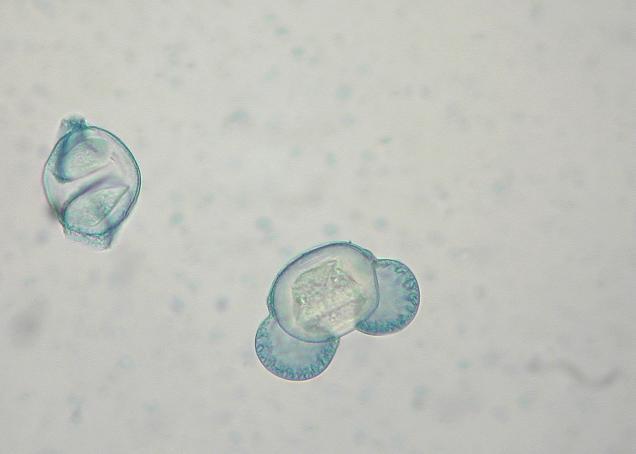 Peľ ako súčasť a indikátor kvalit životného prostredia Karol Mičieta Univerzita Komenského,