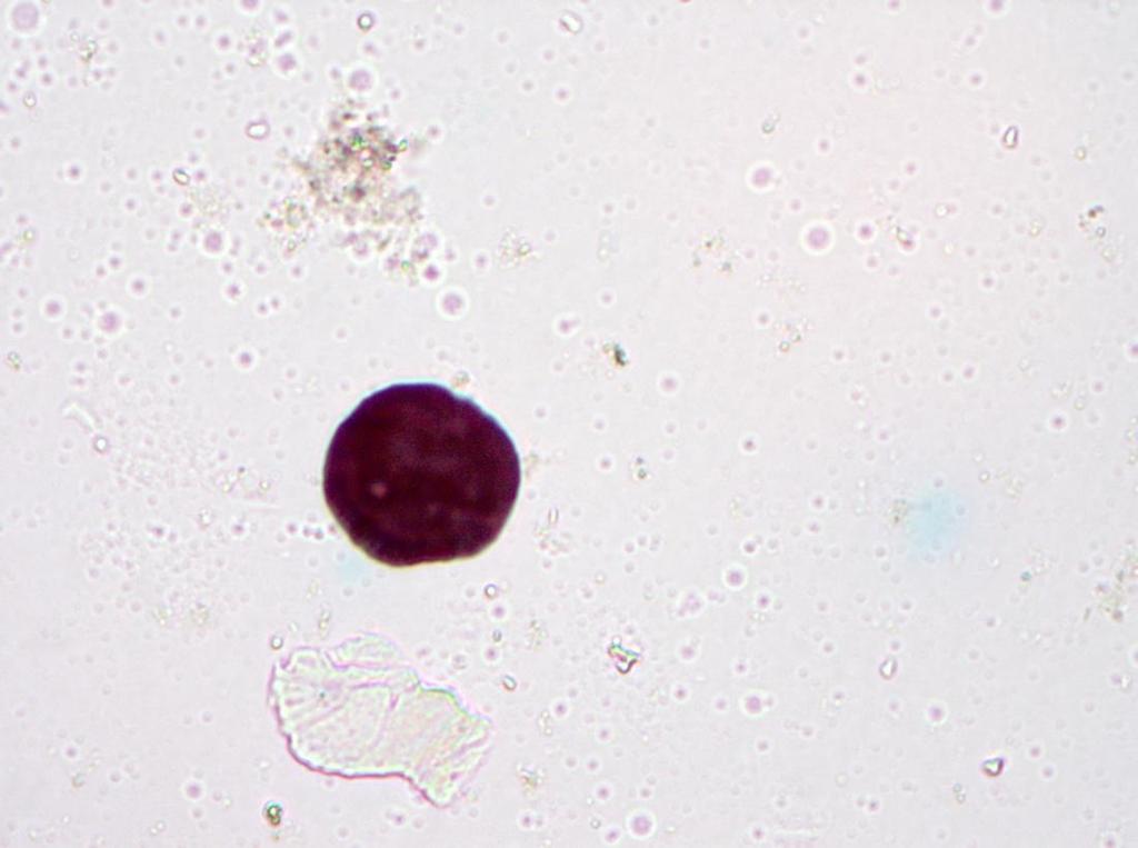 starých 35
