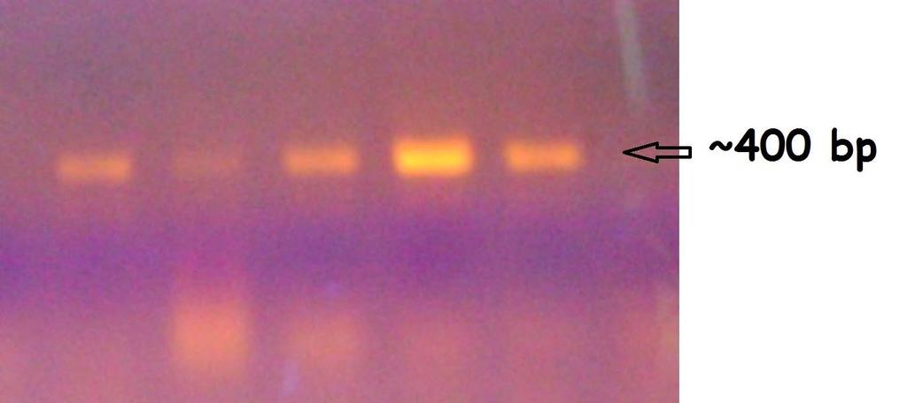 Εικόνα 12: Ηλεκτροφόρηση προϊόντων PCR (COI) Εικόνα 13: Ηλεκτροφόρηση προϊόντων PCR