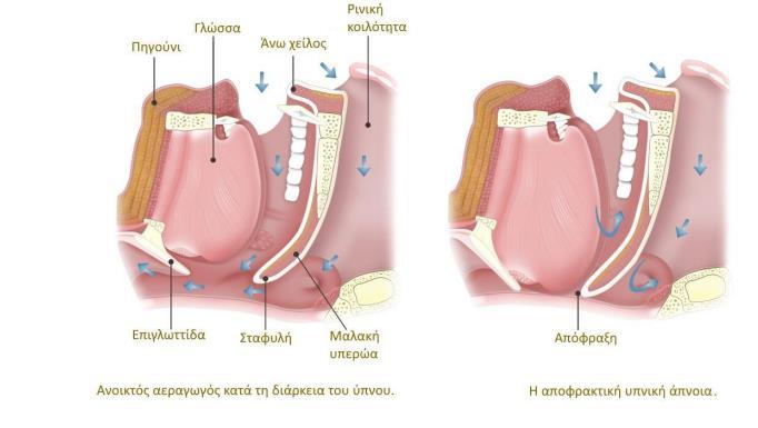 Για τους ενήλικες ο ανώτερος αεραγωγός λειτουργεί ως αντίσταση τον Starling.