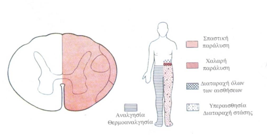 Εικ.135