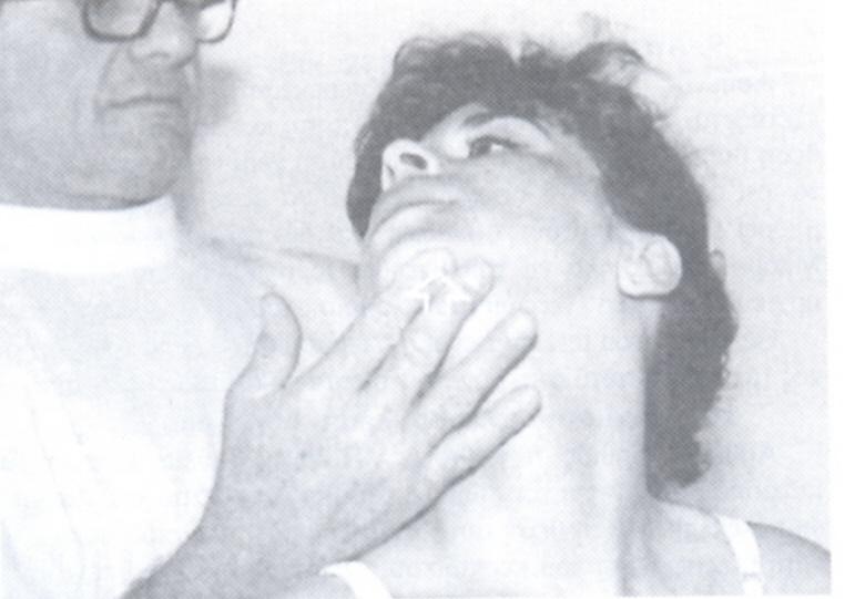 Εικ.199 vi) Έλεγχος σπονδυλικής αρτηρίας (εικ.200): Κατά την δοκιμασία αυτήν ο ασθενής βρίσκεται σε καθιστή ή ύπτια θέση με την κεφαλή σε στροφή,σύστοιχη πλάγια κάμψη και έκταση.