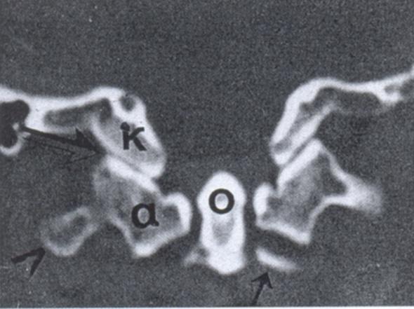 Εικ.80