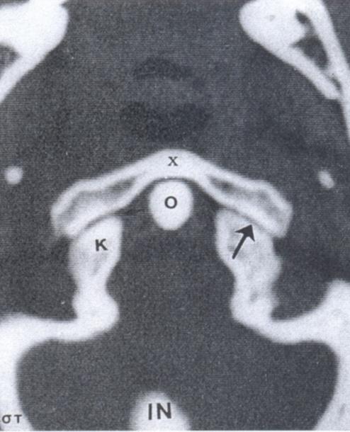 Εικ.82