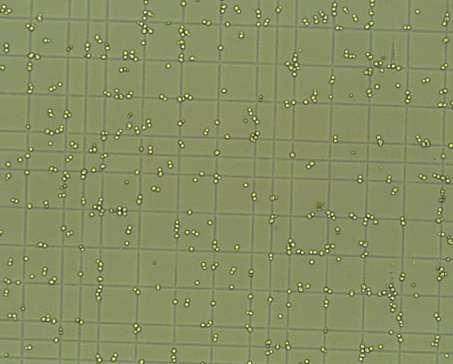 oeni) Saccharomyces