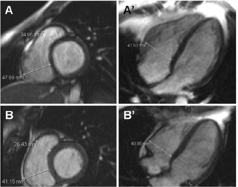 biopsy and/or autopsy, or morphofunctional abnormalities at