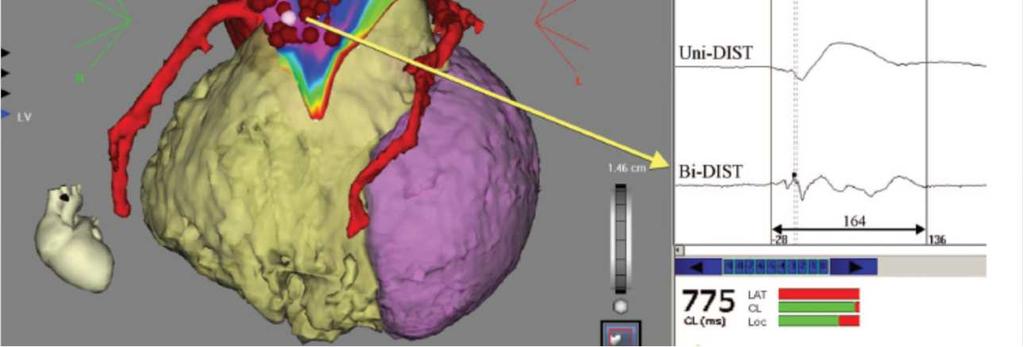 aspect of the RVOT epicardium.