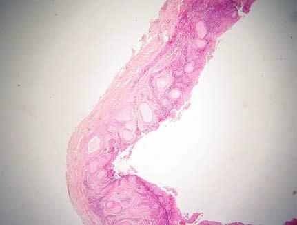 Οδοντογενής κύστη/odontogenic cyst 5 Εικ.
