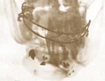 Κρανιογναθοπροσωπικό τραύμα/cranio-maxillofacial trauma 57 Εικ. 20.