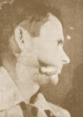 Photographs taken during the two stages of the plastic reconstruction of the right cheek, with a tubular flap raised from the right lateral cervical region. Εικ. 34.