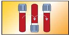 3. UZORKOVANJE: pripremiti pribor za uzimanje uzorka krvi prema traženim pretragama za odabir vrste spremnika poslužite se mrežnim stranicama Zavoda ili naputkom na uputnici identificirati bolesnika