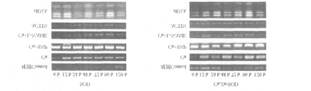 50 37 213 NO Cu APX1 m RNA 2, Cu APX1 mrna,, 72 h SNP Cu, 12 h, L2NAME Cu, 24 h, 48 h, 96 h 2 APX1 RT2PCR F ig.