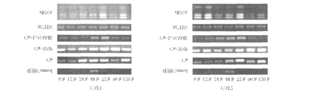 Zn2SOD 48 h SNP Cu SOD Cu, Zn2SOD mrna, SOD 6 h ; Cu, Zn2SOD 72 h L2NAME F ig.