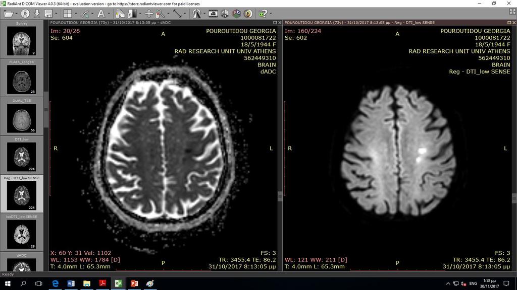 MRI (3 η