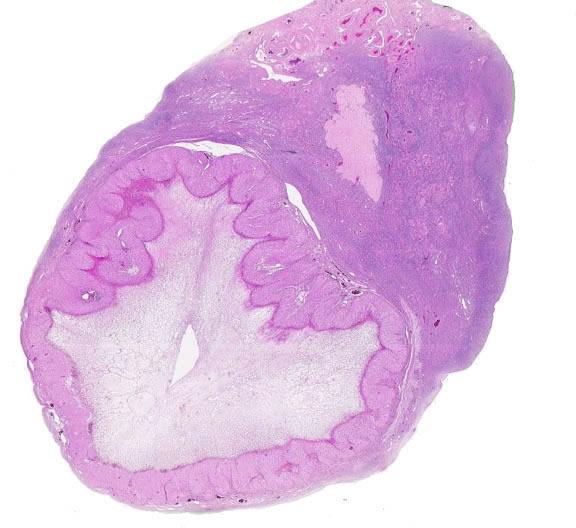 Μετά την ωοθυλακιορρηξία το επικρατούν ωοθυλάκιο αναδιοργανώνεται και μετατρέπεται στο ωχρό σωμάτιο: Τα τριχοειδή αγγεία και οι ινοβλάστες του περιβάλλοντος στρώματος πολλαπλασιάζονται και διαπερνούν