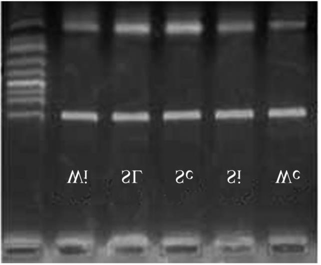 con2 verting enzyme inhibitor trandolapril [ J ]. Am J Hypertens, 1998 ;11 :1065-1073.