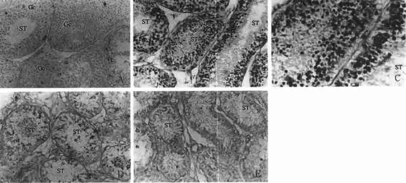 5 : HSF2 mrna 11 649 1 3 Fig11 In situ 3 2end labeling of D NA fragmentation on testicular sections from unilateral cryptorchid monkeys A.