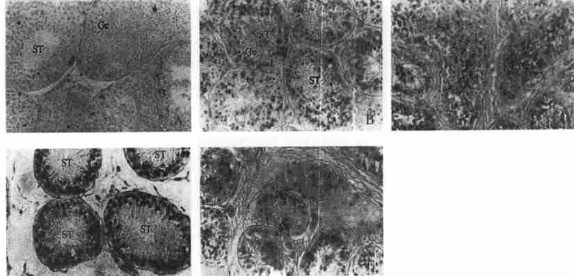 50 6 48 2 3 11 Fig12 In situ 3 2end labeling of D NA fragmentation in testicular cells of TU2treated monkey A.