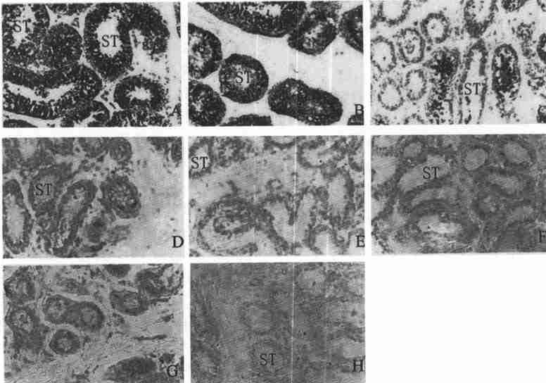: (Seminiferous tubule) 3 HSF2 mrna Fig13 In situ hybridization of HSF2 mrna in monkey normal and cryptorchid testis A.